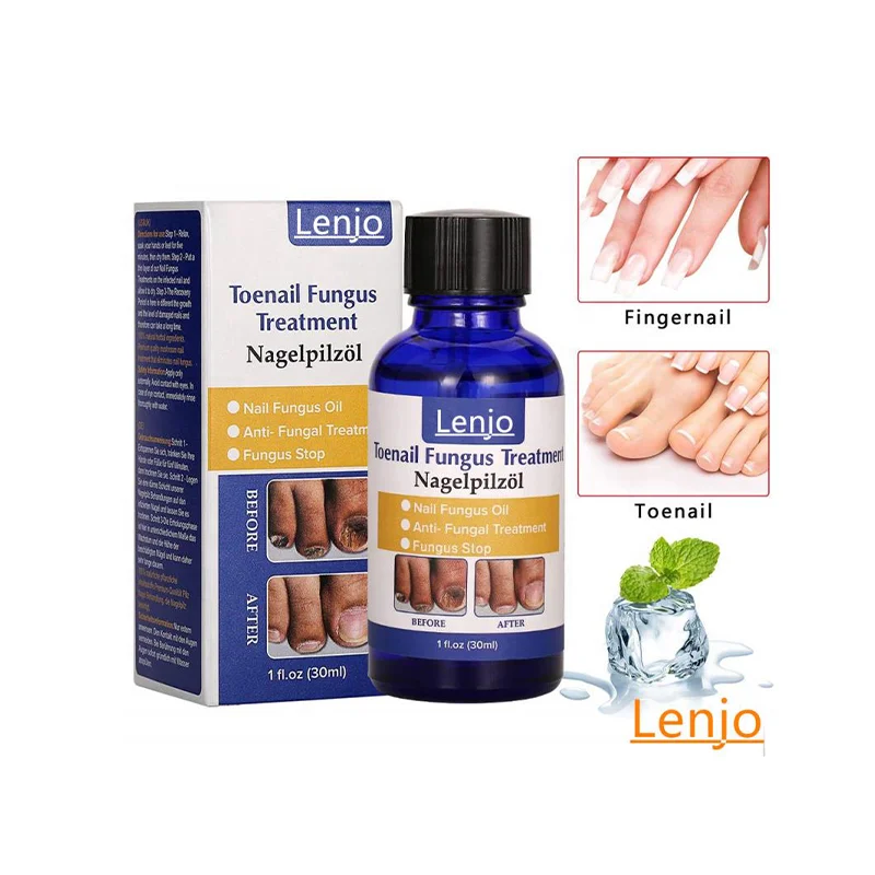 Natural Nail Treatment, Effective Against Nail Infection Restores Discolored & Damaged Nails Treatment Of Toenail Fungus
Natural Nail Treatment, Effective Against Nail Infection Restores Discolored & Damaged Nails Treatment Of Toenail Fungus