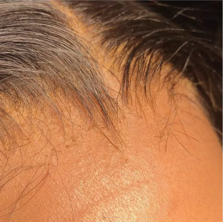 hd transparent lace frontaL high quality 100% raw human hair pre plucked lace frontal wig hd film lace human hair wig
hd transparent lace frontaL high quality 100% raw human hair pre plucked lace frontal wig hd film lace human hair wig