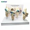 Factory Price 4-stage Osteoarthritis Knee Model