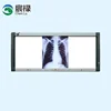 x ray film viewer / medical film viewing box (LED light)