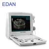 Edan DUS60 U50 U60 portable ultrasound machine / cheap Edan ultrasound machine price