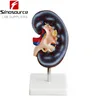 High Quality Natural Color Human Anatomy Kidney Model For Sale