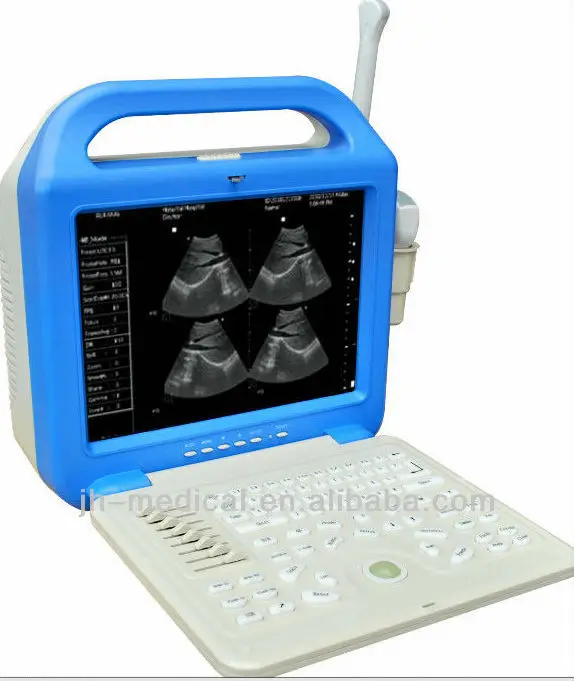 China made digital Laptop Ultrasound Scan machine JH-6200B