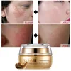 Moisturizing Face Cream Remove Age Spot Scar Pigment Whitening Anti Wrinkle Cream Beauty Miracle Glow Night Cream