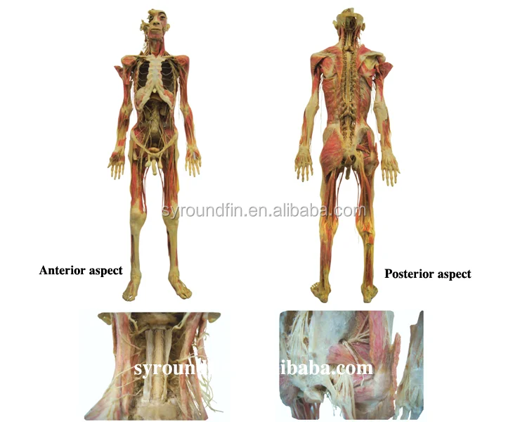 medical learning model hot sale plastinated whole