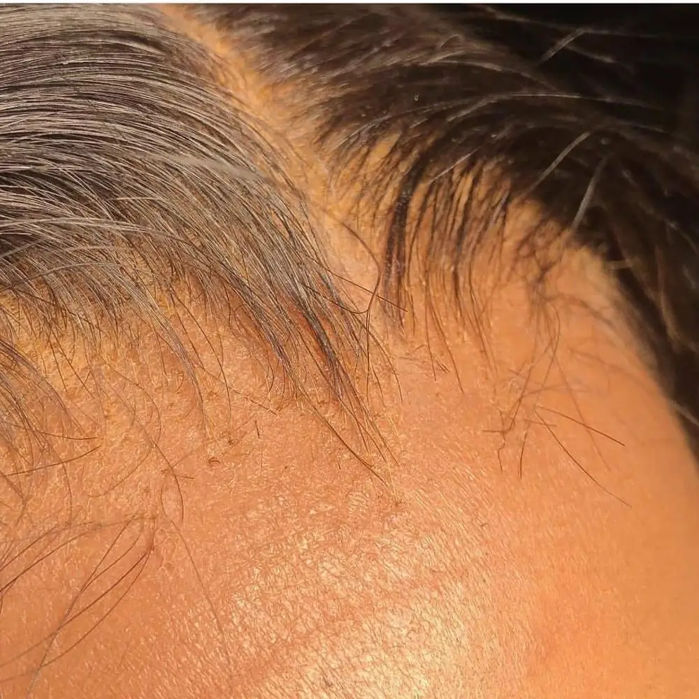 pre plucked 5*5 6*6 13*4 13*6 HD Thin Lace closure frontal,100% Brazilian Human Hair Transparent Lace closure Frontal vendor
pre plucked 5*5 6*6 13*4 13*6 HD Thin Lace closure frontal,100% Brazilian Human Hair Transparent Lace closure Frontal vendor