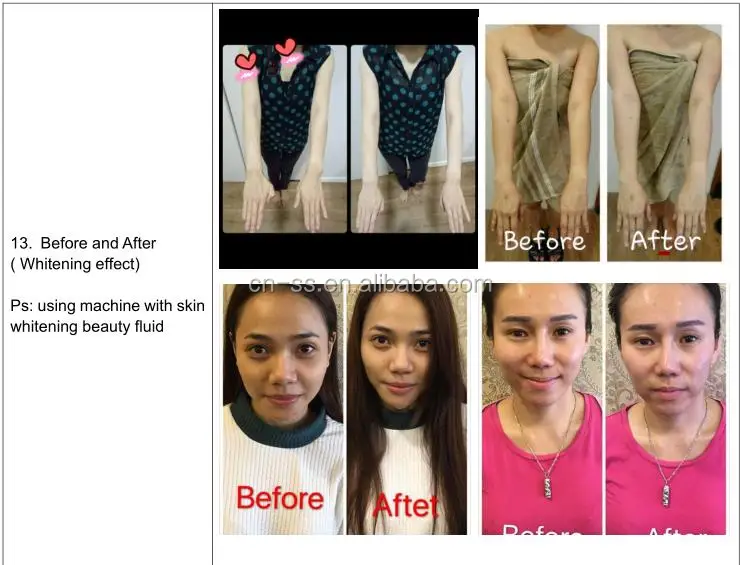 Collagen tanning bed