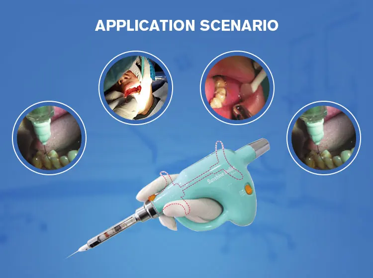 牙科设备牙科麻醉机器便携式麻醉设备