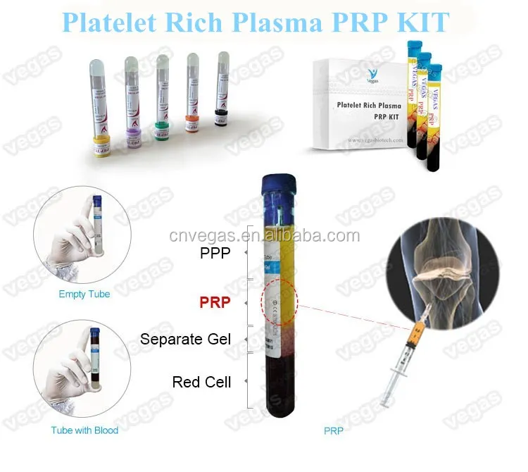   PRP kit.jpg