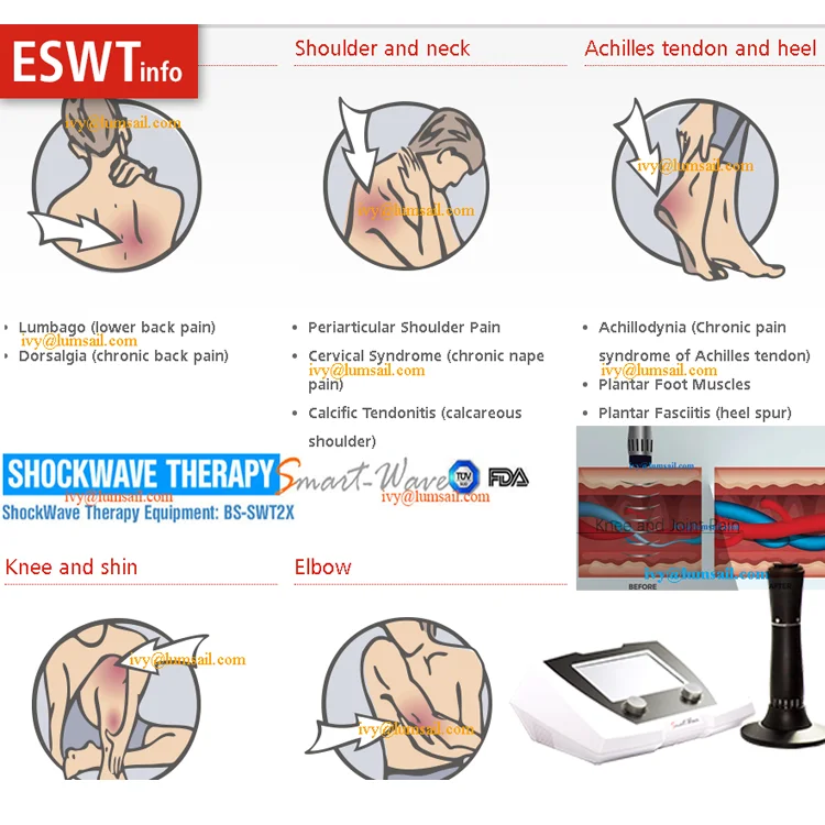 eswt ivys.png