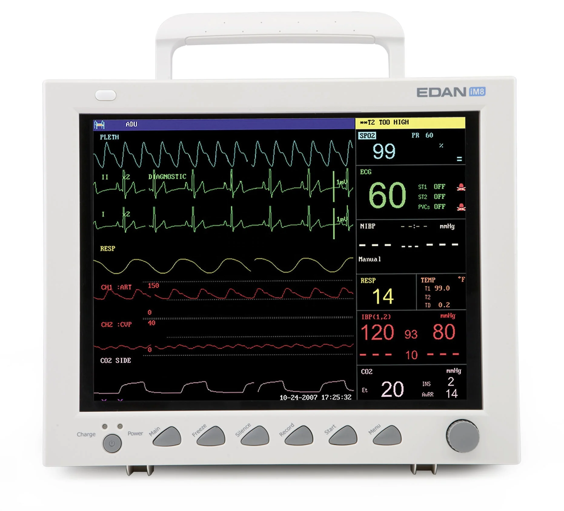 use wall mounted or rolling stand patient monitor edan im8