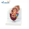 Human Kidney Model Dissection Model of Kidney