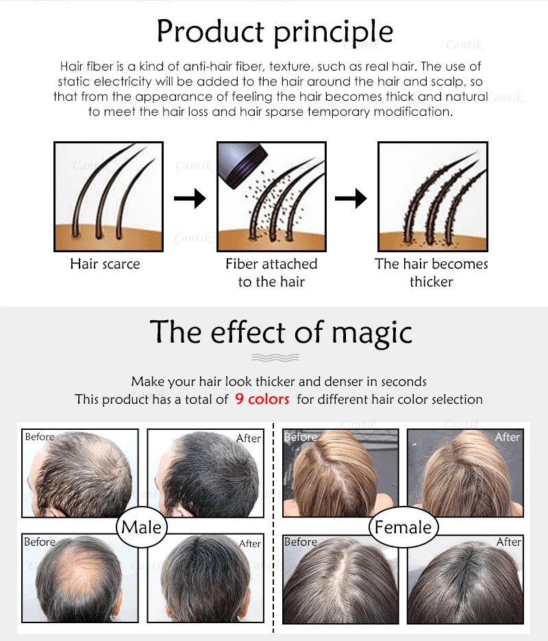 Wholesale Salon Products Hair Loss Treatment For Baldness Keratin