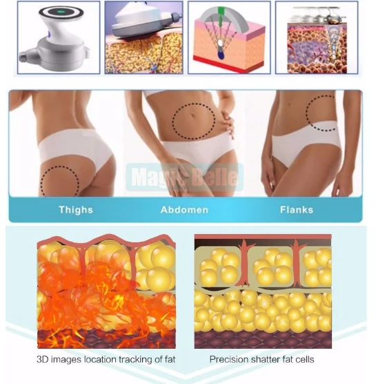 Professional non-invasive fat reduction UltraShape V4 body slimming machine