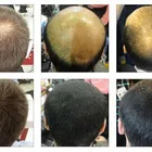 Hair Fiber Concealer Caboki Hair Building Fibers
