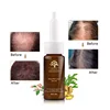 Anti Hair Fall Treatment Ginseng Keratin Bottle Anti DHT Nourish Scalp India Hair Tonic for Growth