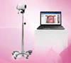 Digital Edan Video Vaginal Colposcope for Gynecology Double LED Diaphragm