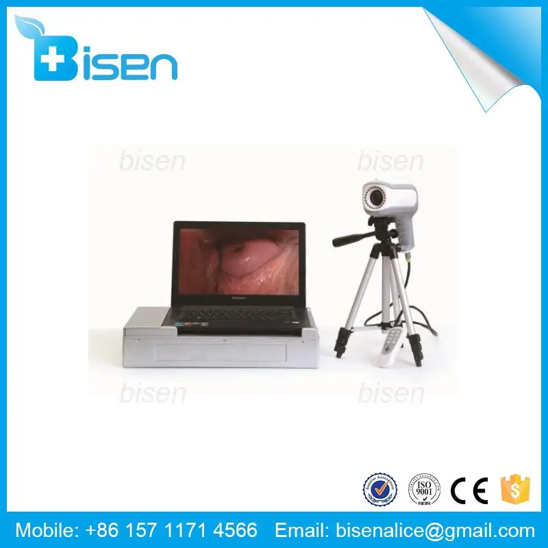 High Definition For Gynecology Digital Electronic Colposcope By Ce/Fda/Iso Approved Gynecataptron