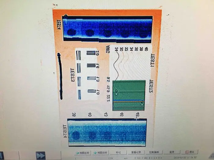 xray picture