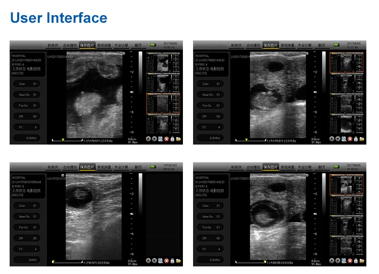 Vet Ultrasound Device