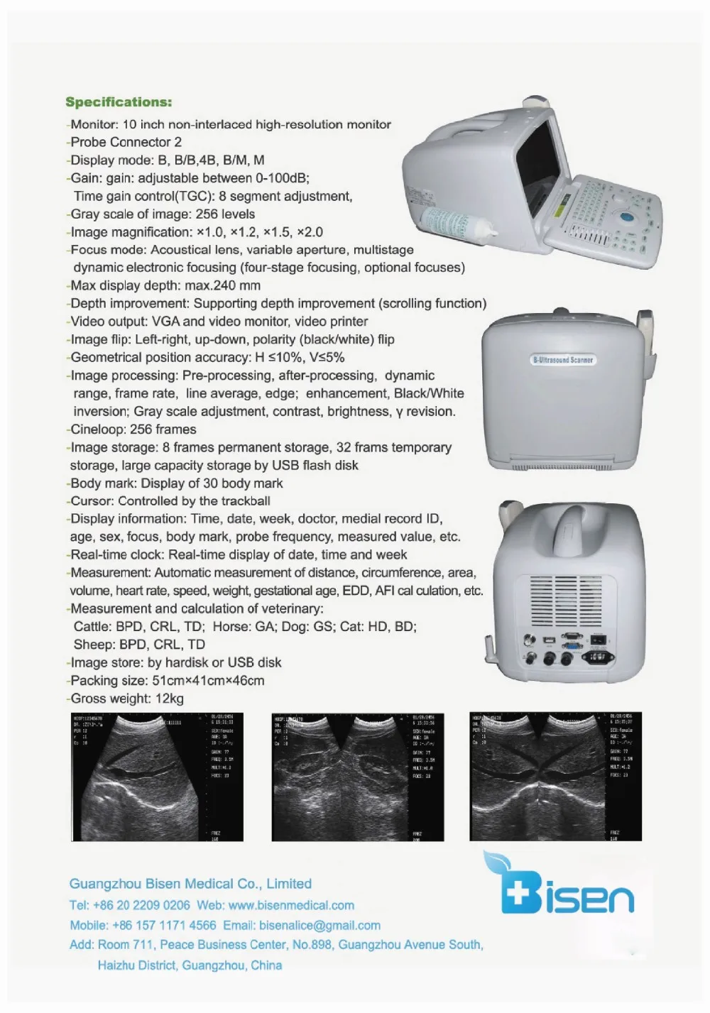 Cheap powerful function ultrasound scanner with convex array probe pretty and portable appearance