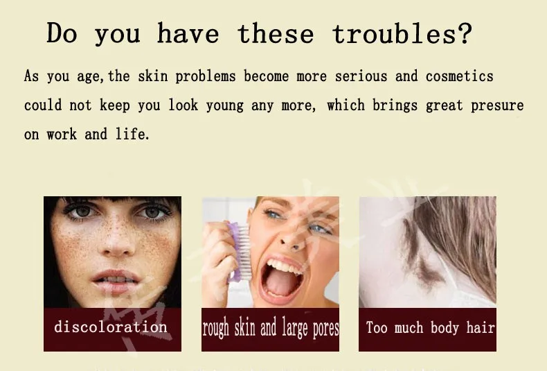 high frequency facial machine OPT SHR IPL RF Nd YAG Laser beauty equipment