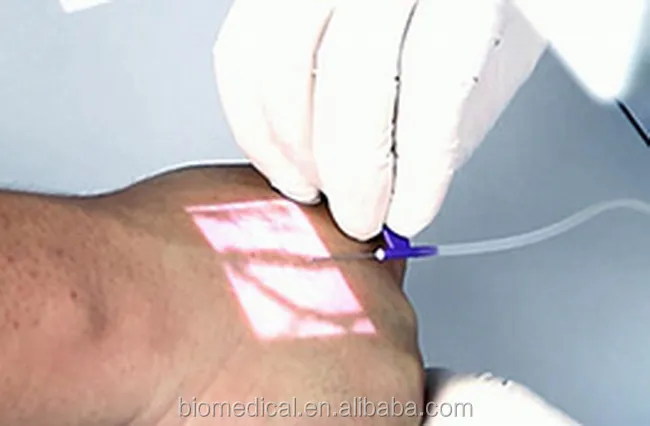 vein detector