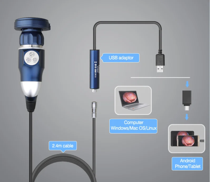 Mini Medical Portable Endoscopic Camera Hd For Ent Gynecology Urology