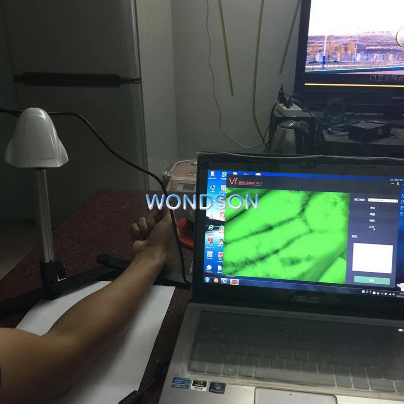adults baby palm arm finger vein finding image display iv