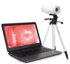 Digital Laptop Colposcope for Gynaecological/vaginal & uterine diagnosis/surgery