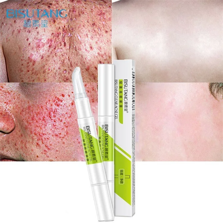 BISUTANG Natural Extract Anti Acne Cream Gel Moisturizer Oil Control Against Scar Acne Removal Cream Acne Cream
BISUTANG Natural Extract Anti Acne Cream Gel Moisturizer Oil Control Against Scar Acne Removal Cream Acne Cream