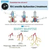 low intensity extracorporeal shock waves especially for problems of erectile dysfunction