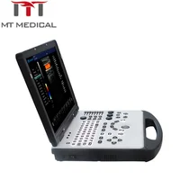 Hospital Equipment Portable Ultrasound Machine With