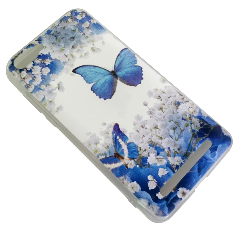 MODAZONGYE Soft Cartoon Case For Doogee X30 Case Cover Silicone Back Cover Phone Case For Doogee X30 X 30 X30L X 30L 5.5 inch (2)