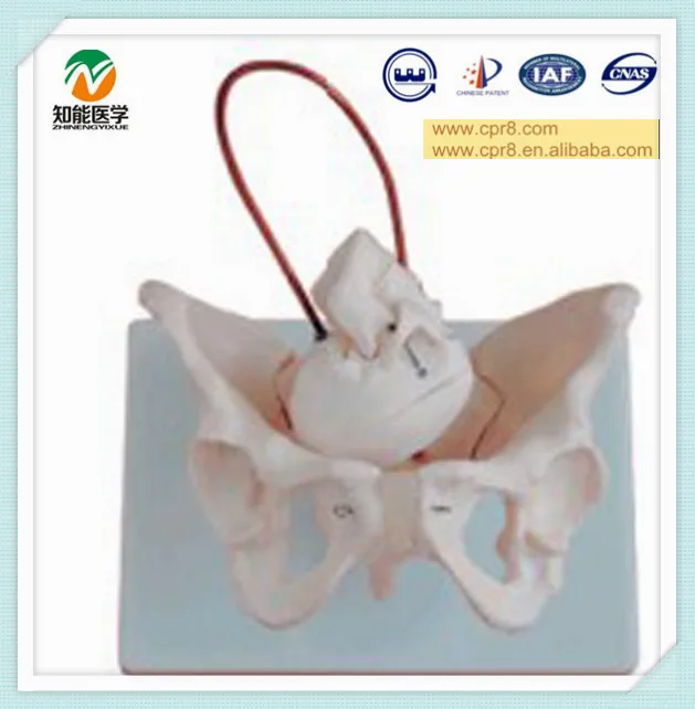 BIX-A1026 Female pelvis with fetal skull model