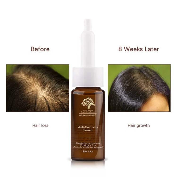 Professional Salon Hair Tonic Nourish Scalp Anti Hair Loss Serum