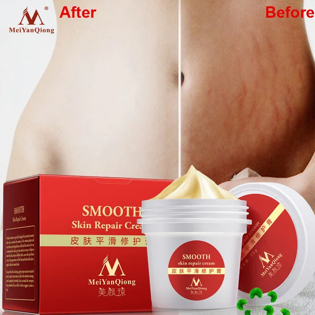 MeiYanQiong Smooth Skin Cream For Stretch Marks Scar Removal To Maternity Skin Repair Body Cream Remove Scar Care Postpartum
MeiYanQiong Smooth Skin Cream For Stretch Marks Scar Removal To Maternity Skin Repair Body Cream Remove Scar Care Postpartum