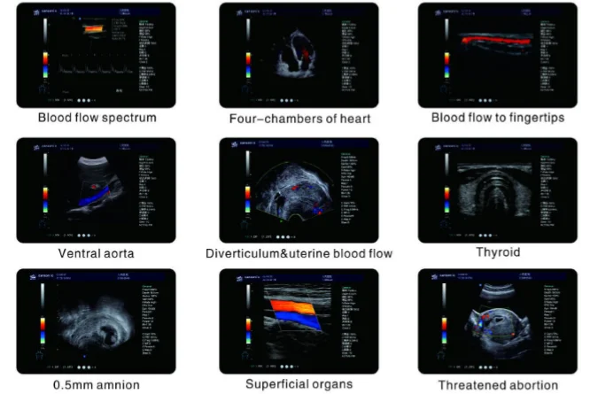 big promotion led high resolution color doppler h