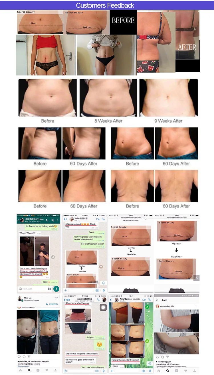 Beijing KES fat freezing cryo fat reducing slimming beauty machine cellulite