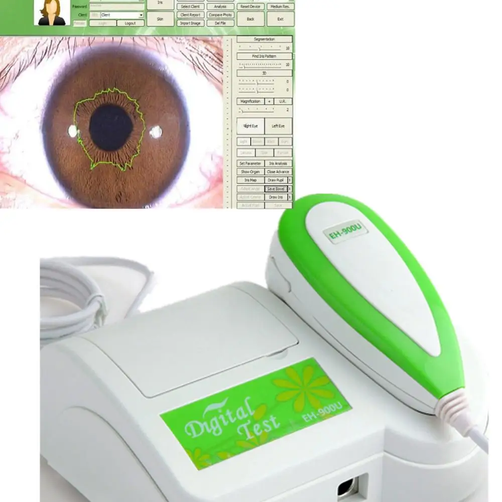JYtop 2019 New Skin & Hair Iris Lens Analysis 5.0 Mega Pixels USB Iriscope Skin & Hair Scope 30x Iris Lens
JYtop 2019 New Skin & Hair Iris Lens Analysis 5.0 Mega Pixels USB Iriscope Skin & Hair Scope 30x Iris Lens