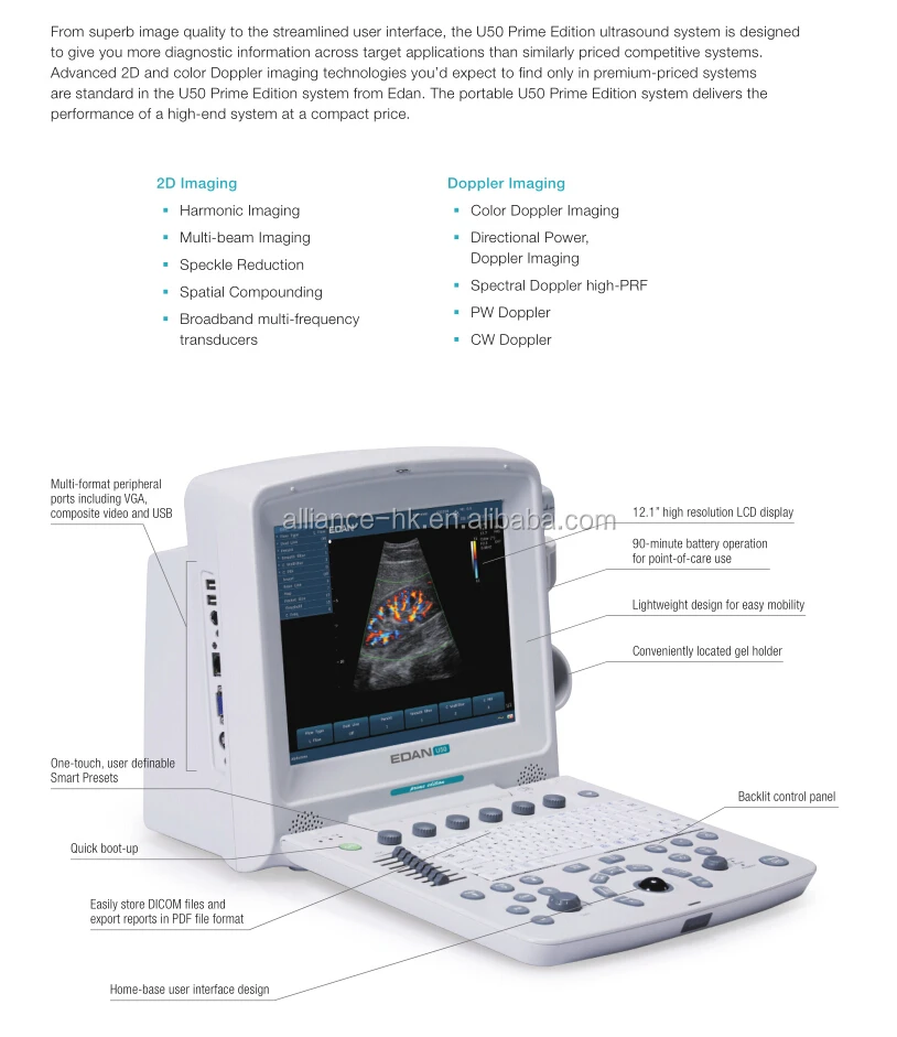 edan u50 portable color doppler ultrasound