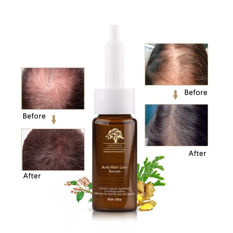 World Best Herbal Hair Regrowth Product Fast Hair Growth Oil Serum