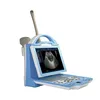 GE Best Portable Ultrasound/digital color doppler ultrasound machine MSLPU27