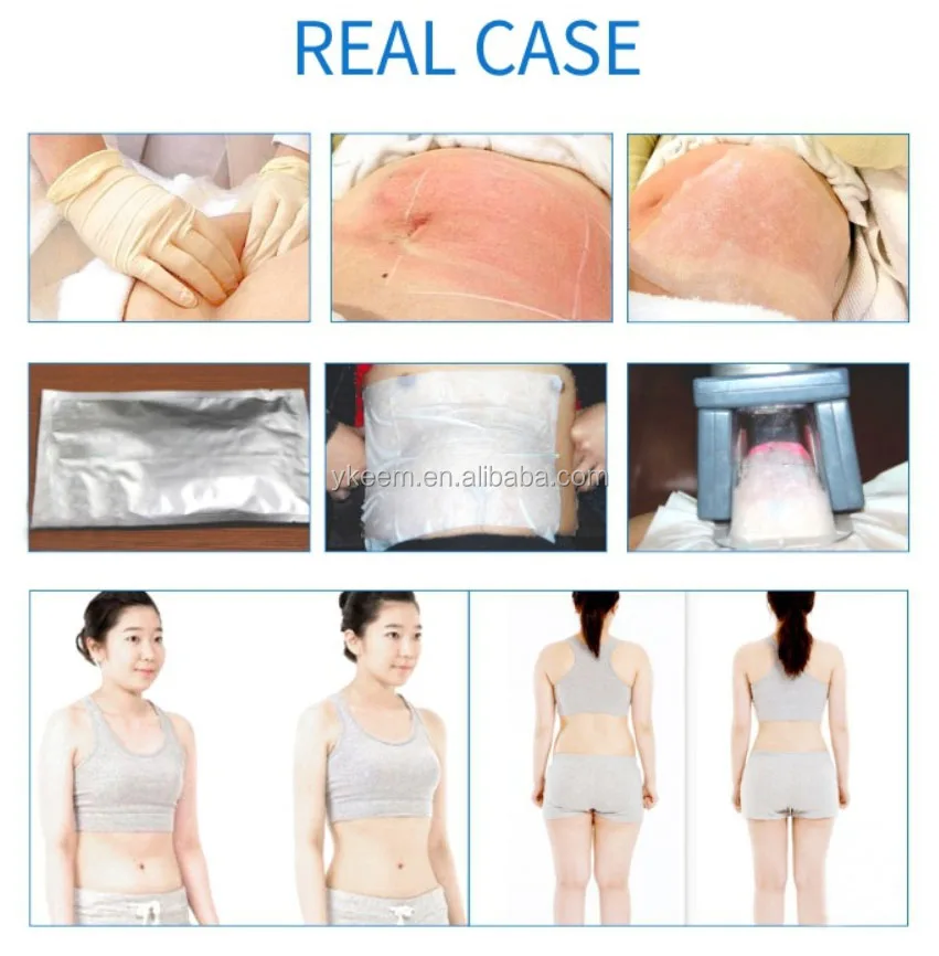 weight loss products.jpg