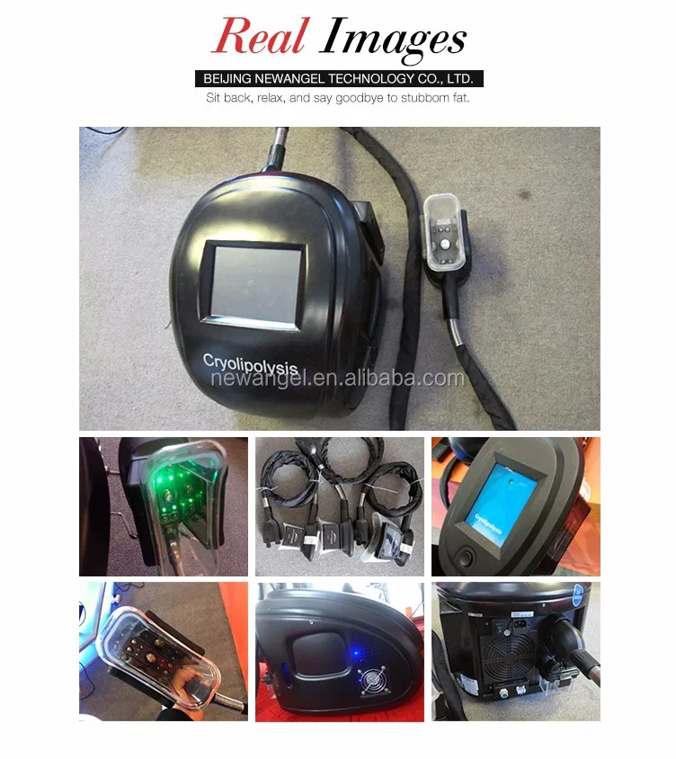 cryolipolysis body contouring machine.jpg