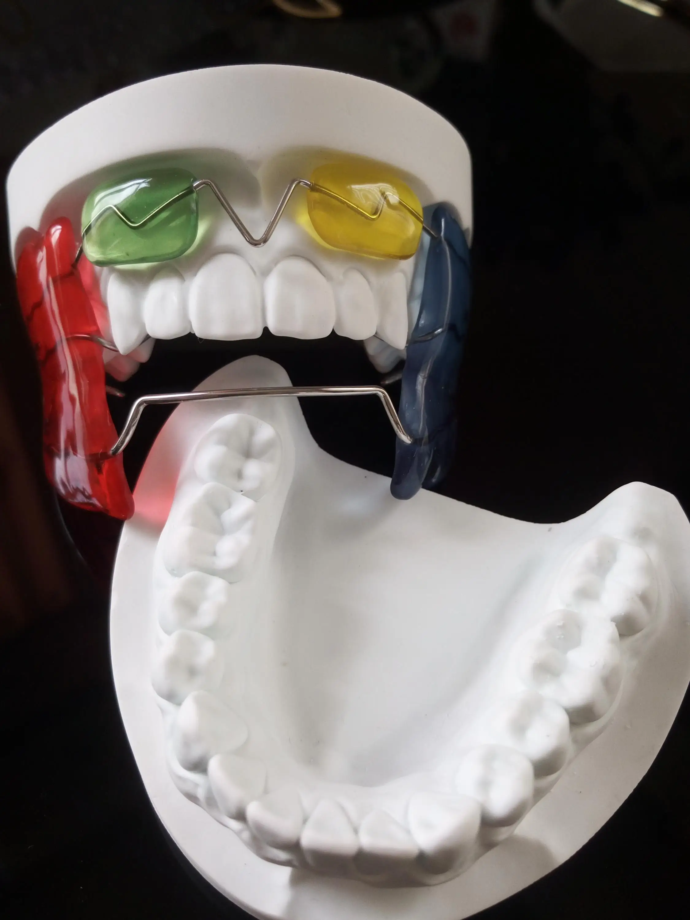Detes Dental Lab Frankel Appliance For Orthodontic View Frankel