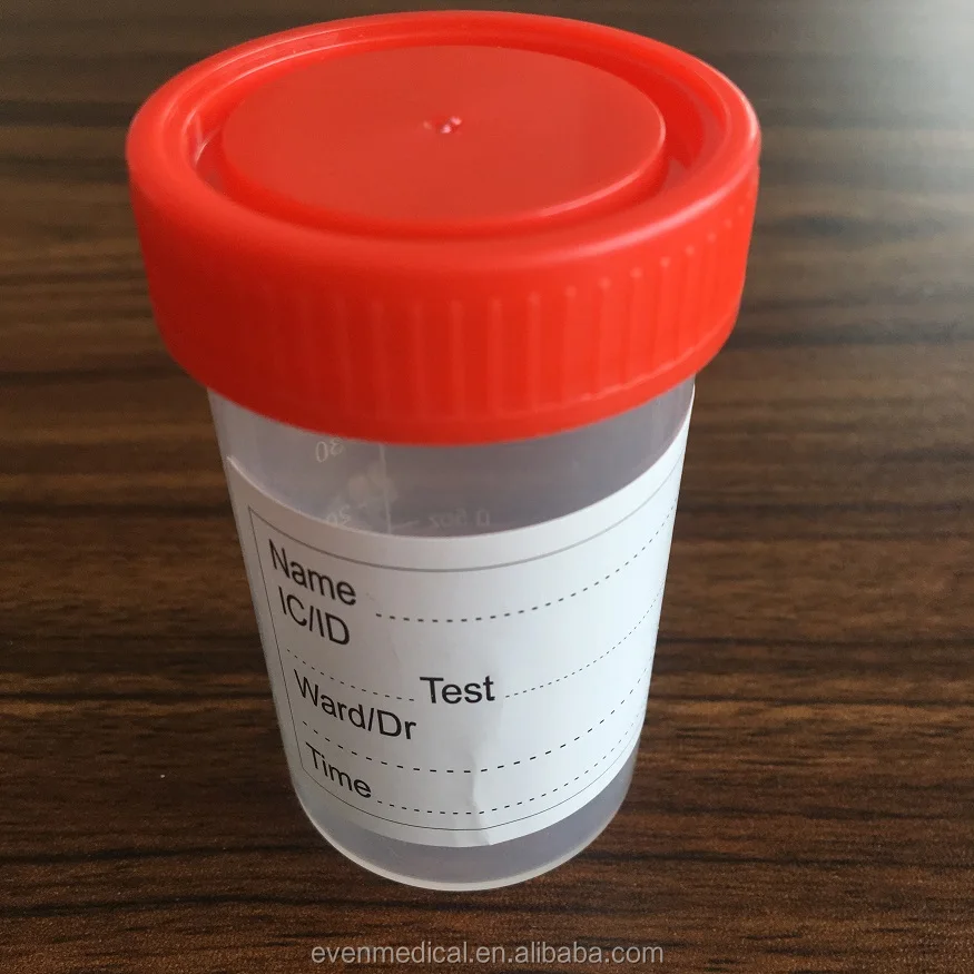 30 ml-120 ml de Urina Estéril caotainer copo de urina para a coleta de urina