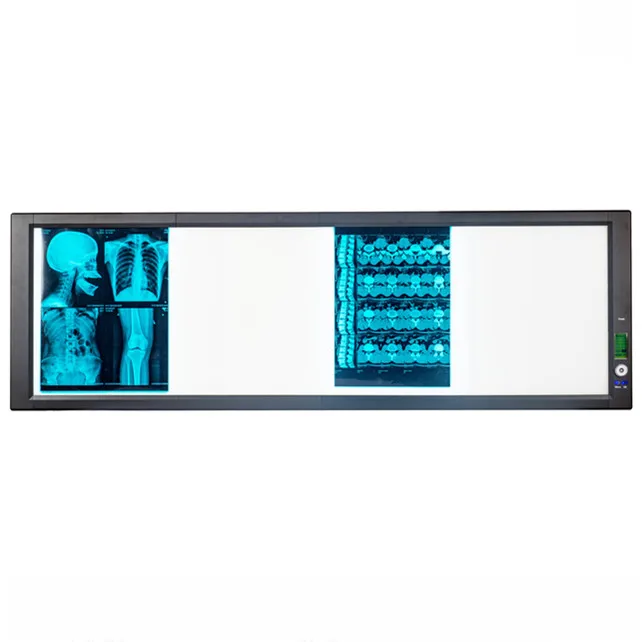 Wall or Bracket Mounted LED Medical X-ray Illuminator / Ultra High Brightness ZG Series Ultra Slim LED Medical Film Viewer