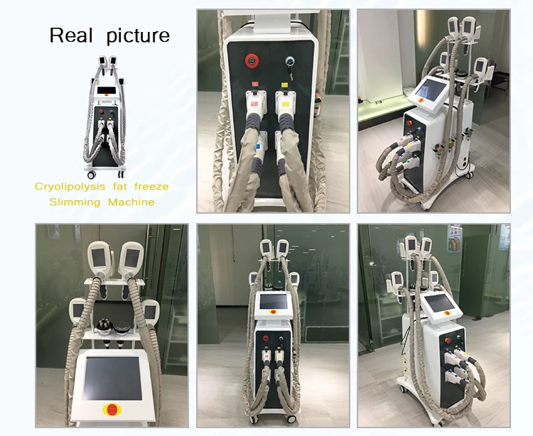 cryolipolysis machine hot sell in europe.jpg
