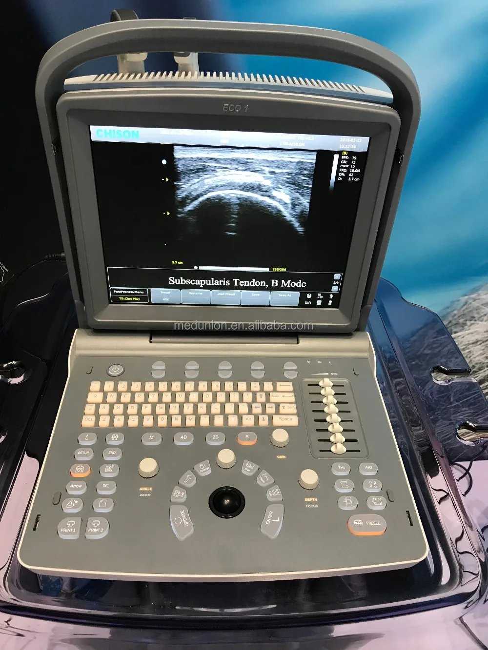 Professional Veterinary Ultrasound Machine Chison Eco Vet